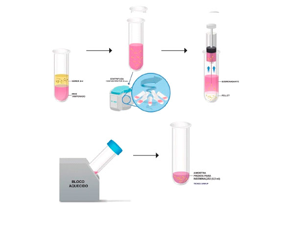 preparacao-do-semen2